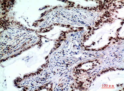 14 - TP53INP2 Polyclonal Antibody AP73916