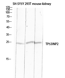 1 - TP53INP2 Polyclonal Antibody AP73916
