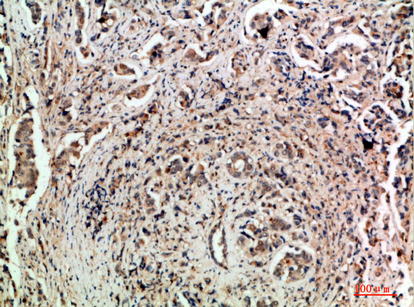 14 - TLE1/2/3/4 Polyclonal Antibody AP73929