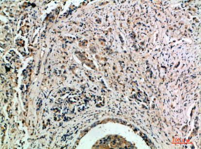 14 - TLE1/2/3/4 Polyclonal Antibody AP73929