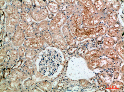 14 - TLE1/2/3/4 Polyclonal Antibody AP73929