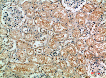 14 - TLE1/2/3/4 Polyclonal Antibody AP73929