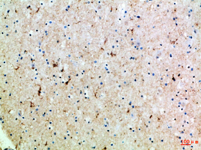 14 - GABA T-1 Polyclonal Antibody AP74027