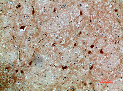 14 - NFAT5 Polyclonal Antibody AP74036