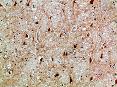 14 - NFAT5 Polyclonal Antibody AP74036