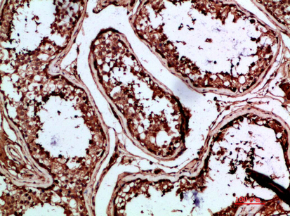 14 - INSL3 Polyclonal Antibody AP74093