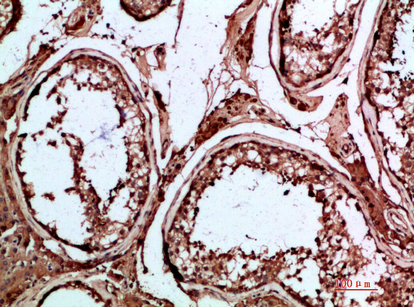 14 - INSL3 Polyclonal Antibody AP74093