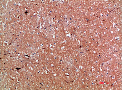 14 - Tenascin-R Polyclonal Antibody AP74098
