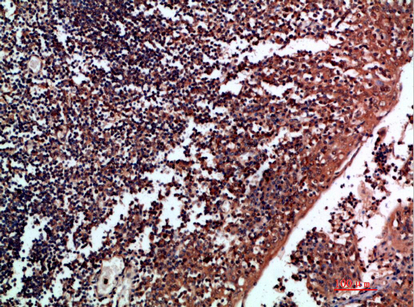 14 - Tenascin-R Polyclonal Antibody AP74098