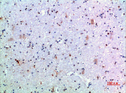 14 - GH Polyclonal Antibody AP74104