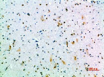 14 - GH Polyclonal Antibody AP74104