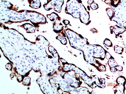 14 - GH Polyclonal Antibody AP74104