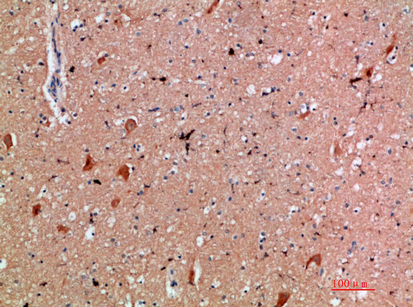 14 - CD300e Polyclonal Antibody AP74117