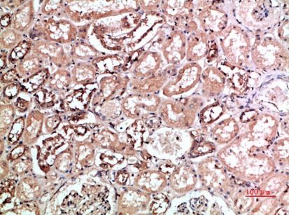 14 - CD158f1/2 Polyclonal Antibody AP74119