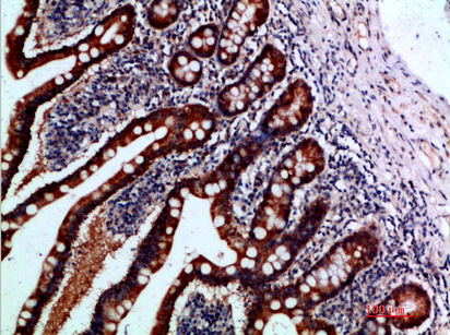 14 - IL-1F7 Polyclonal Antibody AP74137