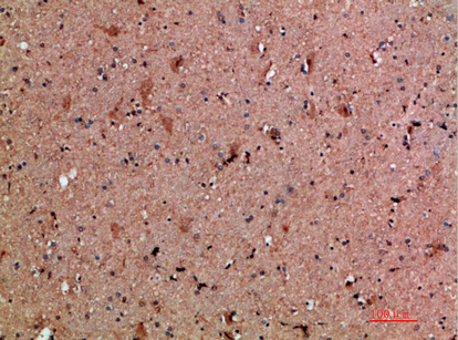 14 - NNT-1 Polyclonal Antibody AP74140