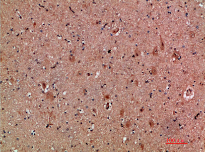 14 - NNT-1 Polyclonal Antibody AP74140