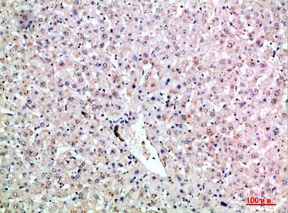 14 - LT-β Polyclonal Antibody AP74154