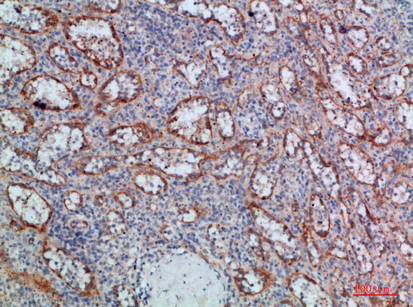 14 - LT-β Polyclonal Antibody AP74154