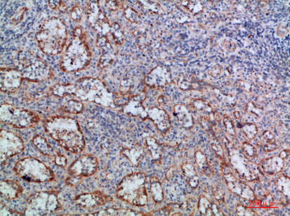 14 - LT-β Polyclonal Antibody AP74154