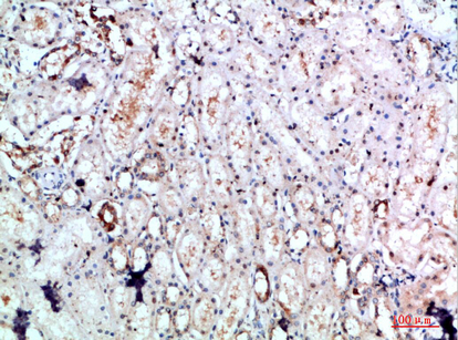 14 - DLEU7 Polyclonal Antibody AP74169