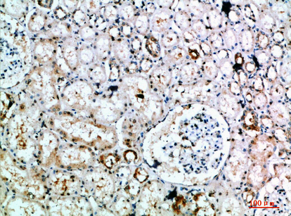 14 - DLEU7 Polyclonal Antibody AP74169