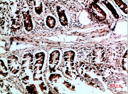 14 - VHL Polyclonal Antibody AP74171