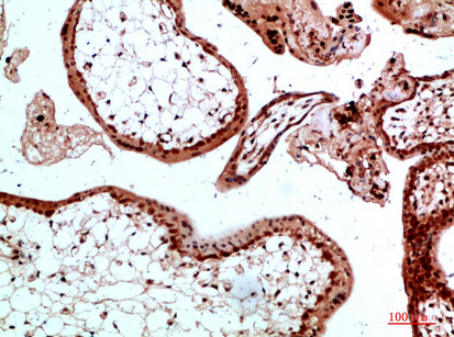 14 - Ub Polyclonal Antibody AP74178
