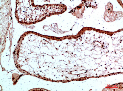 14 - Ub Polyclonal Antibody AP74178