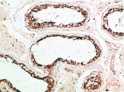 14 - PACAP Polyclonal Antibody AP74181