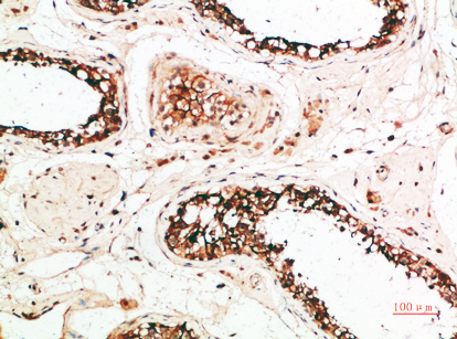 14 - PACAP Polyclonal Antibody AP74181