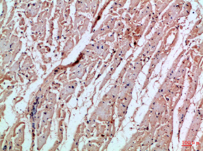14 - MIA Polyclonal Antibody AP74198