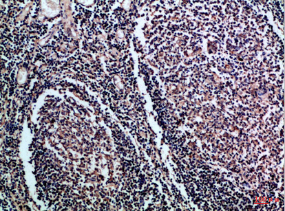14 - CD1A/B Polyclonal Antibody AP74209