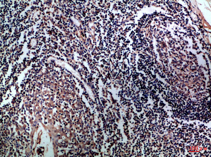 14 - CD1A/B Polyclonal Antibody AP74209