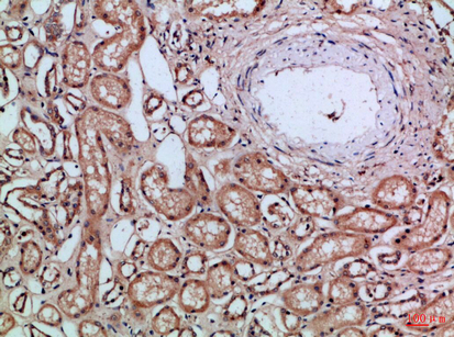 14 - CD66a/b/c Polyclonal Antibody AP74213