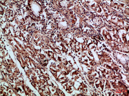 14 - CD66a/b/c Polyclonal Antibody AP74213