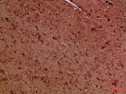 14 - EYA1/EYA4 Polyclonal Antibody AP74233