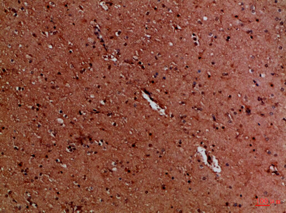 14 - EYA1/EYA4 Polyclonal Antibody AP74233