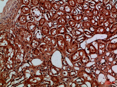 14 - EYA1/EYA4 Polyclonal Antibody AP74233