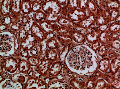 14 - EYA1/EYA4 Polyclonal Antibody AP74233