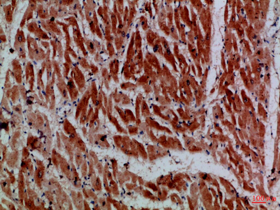 14 - MYH6/MYH7 Polyclonal Antibody AP74236