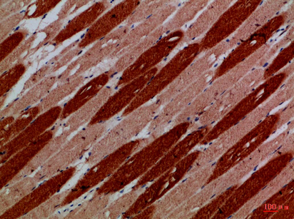 14 - MYH6/MYH7 Polyclonal Antibody AP74236
