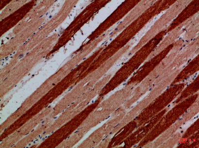 14 - MYH6/MYH7 Polyclonal Antibody AP74236