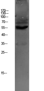 1 - OAT1 Polyclonal Antibody AP74348