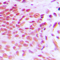 2 - Anti-NAB2 Antibody AP60035