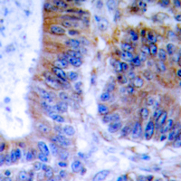 2 - Anti-TNFAIP1 Antibody AP60063
