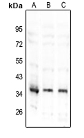 1 - Anti-TNFAIP1 Antibody AP60063