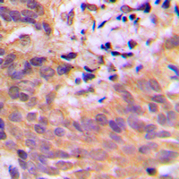 2 - Anti-CDKL2 Antibody AP60073