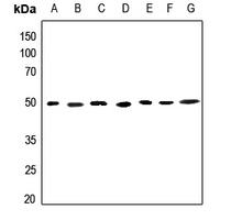 1 - Anti-ACOT2 Antibody AP60088