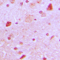 2 - Anti-TBX22 Antibody AP60103